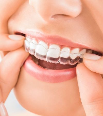 Ortodonzia dentista palermo